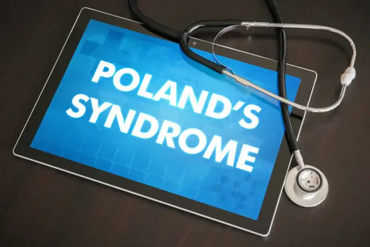 Poland syndrome