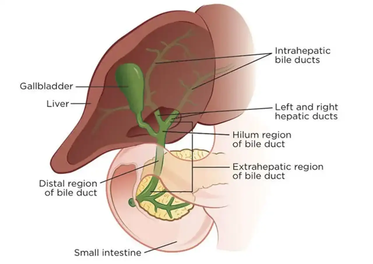Types of Bile Duct Cancer