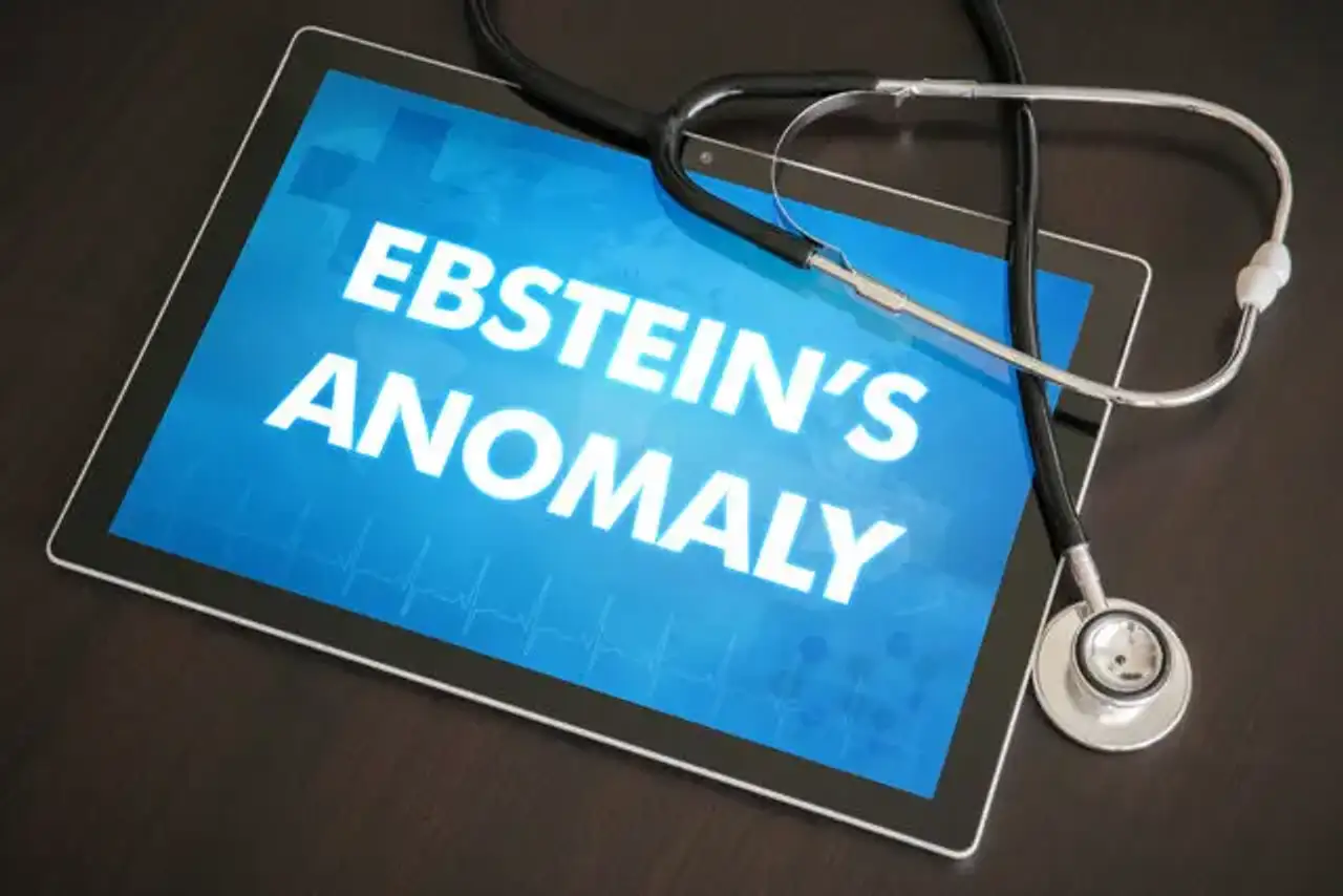 Ebstein's anomaly