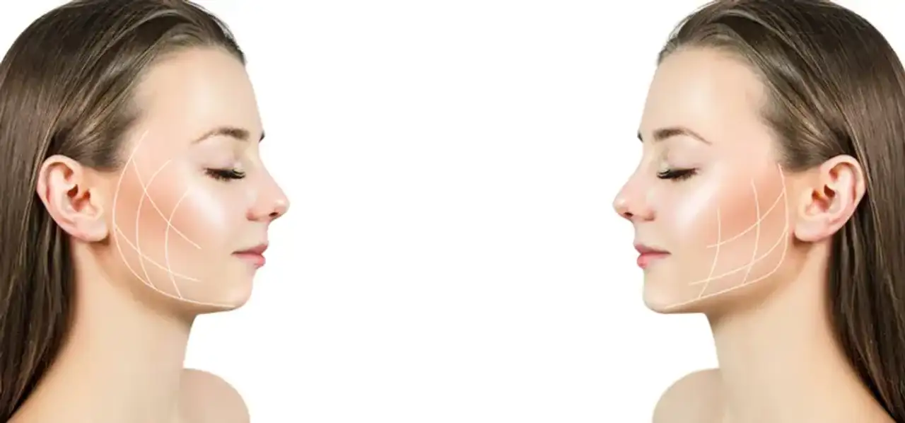 Jaw Surgery Cost by Countries