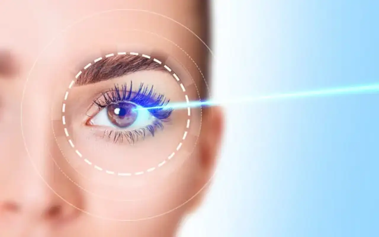 Sự kiện chỉnh sửa thị giác bằng laser