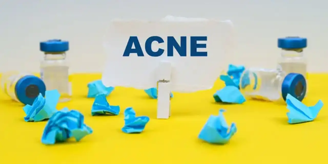 Acne clinic