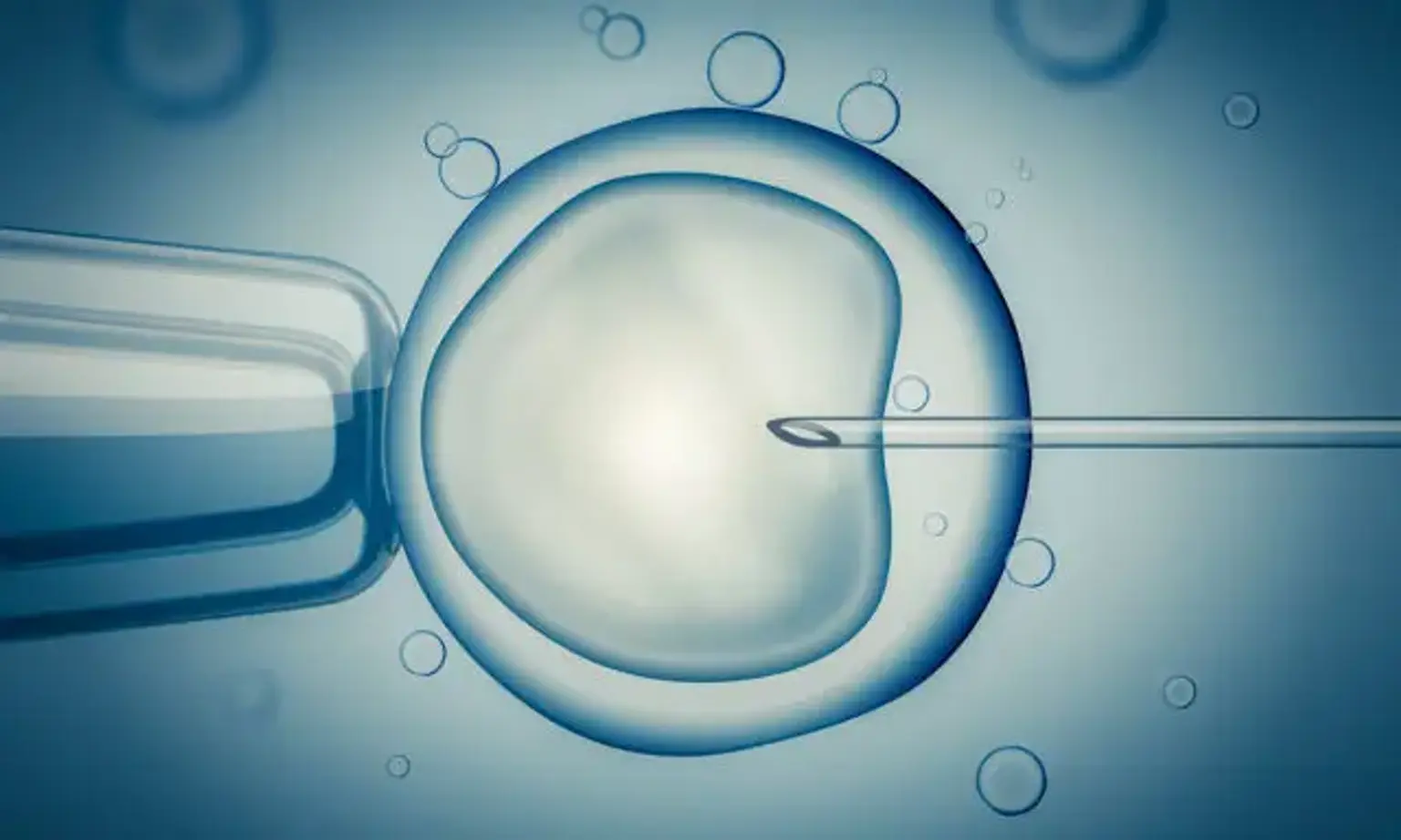 In-Vitro Fertilization