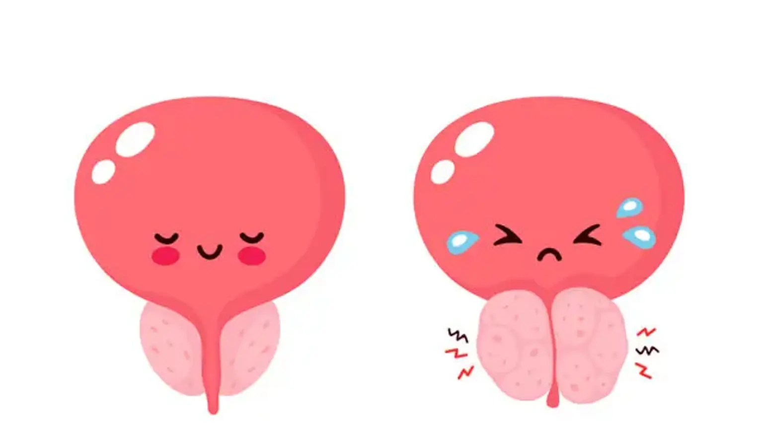 Benign Prostatic Hyperplasia