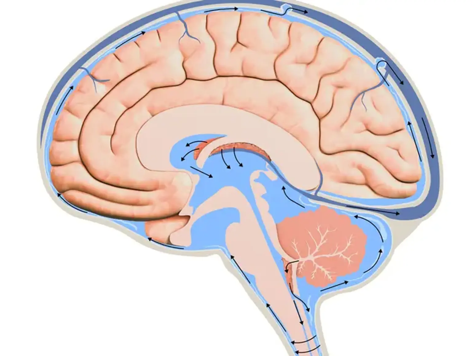 Ventriculoperitoneal (VP) Shunt Surgery