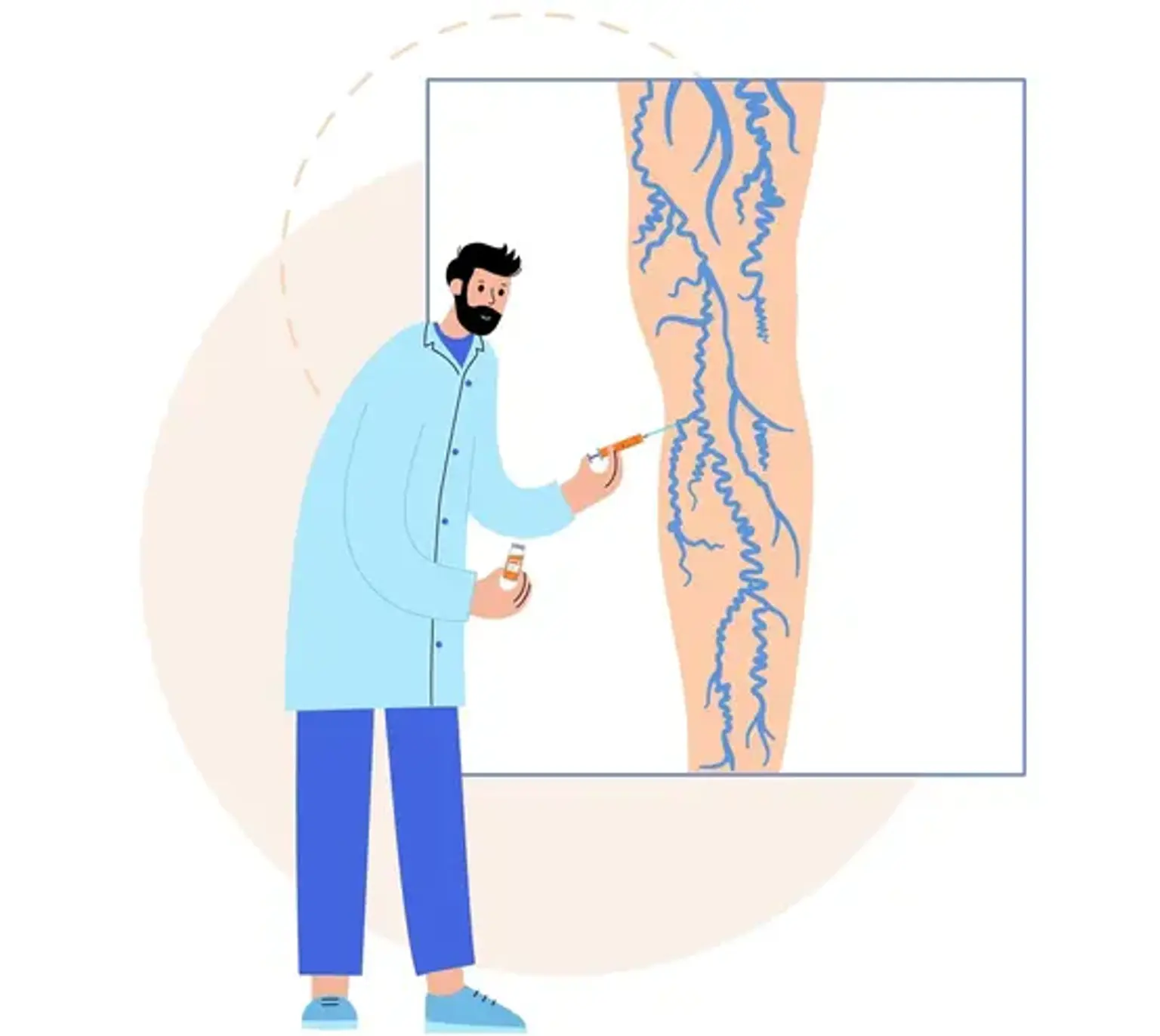 Sclerotherapy for Spider Veins