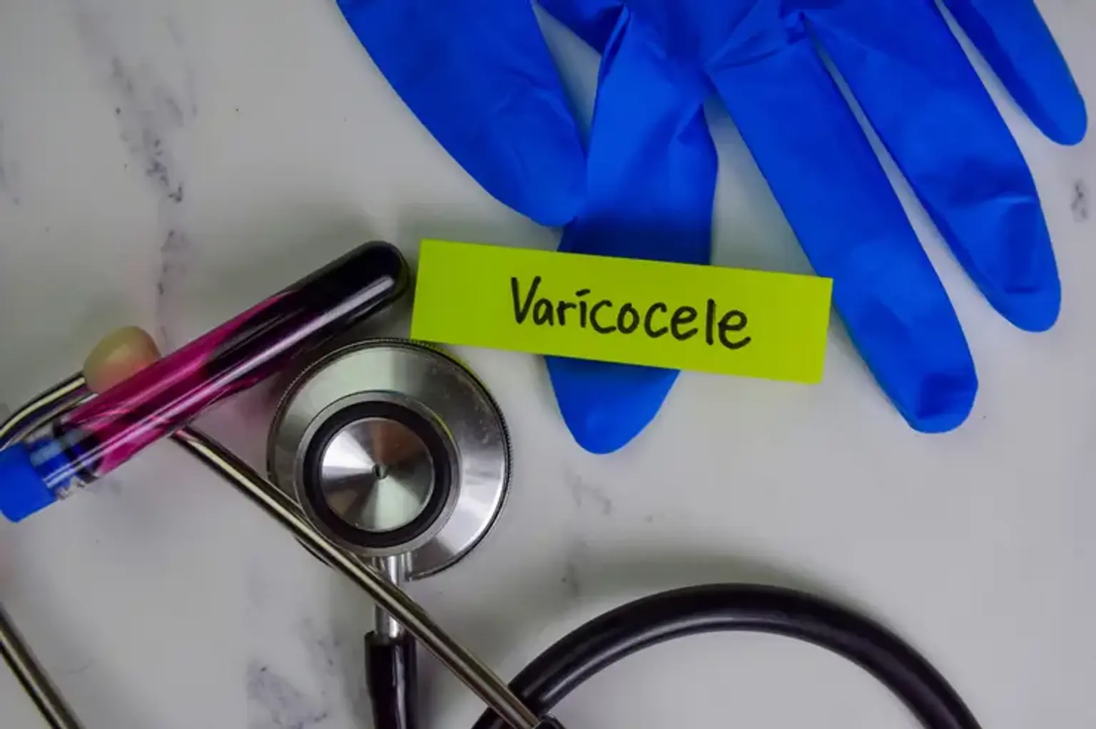 Varicocele