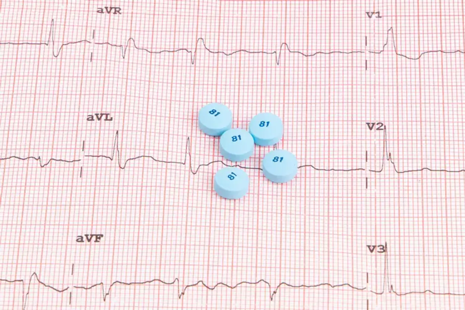 Inflammatory heart diseases