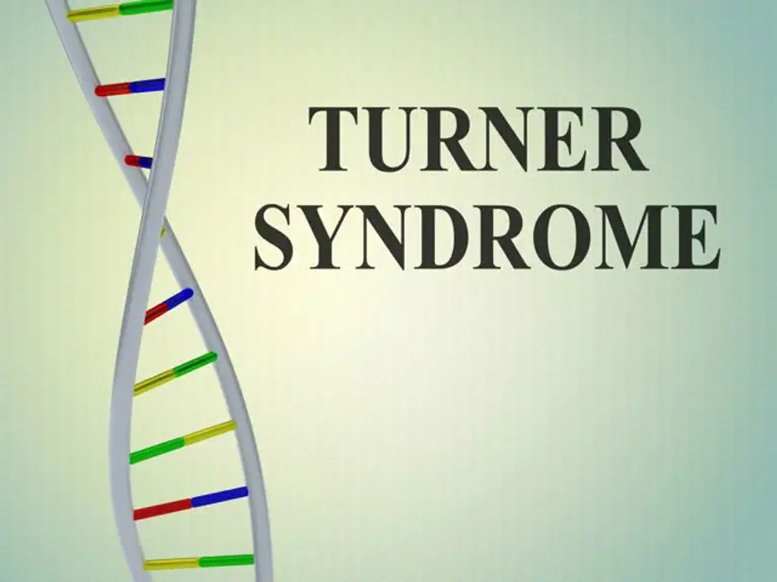 Turner syndrome