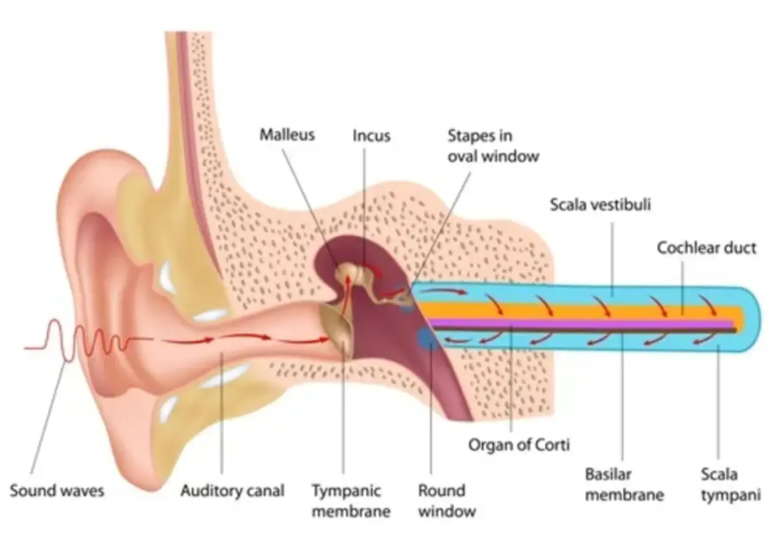 Perilymph fistula