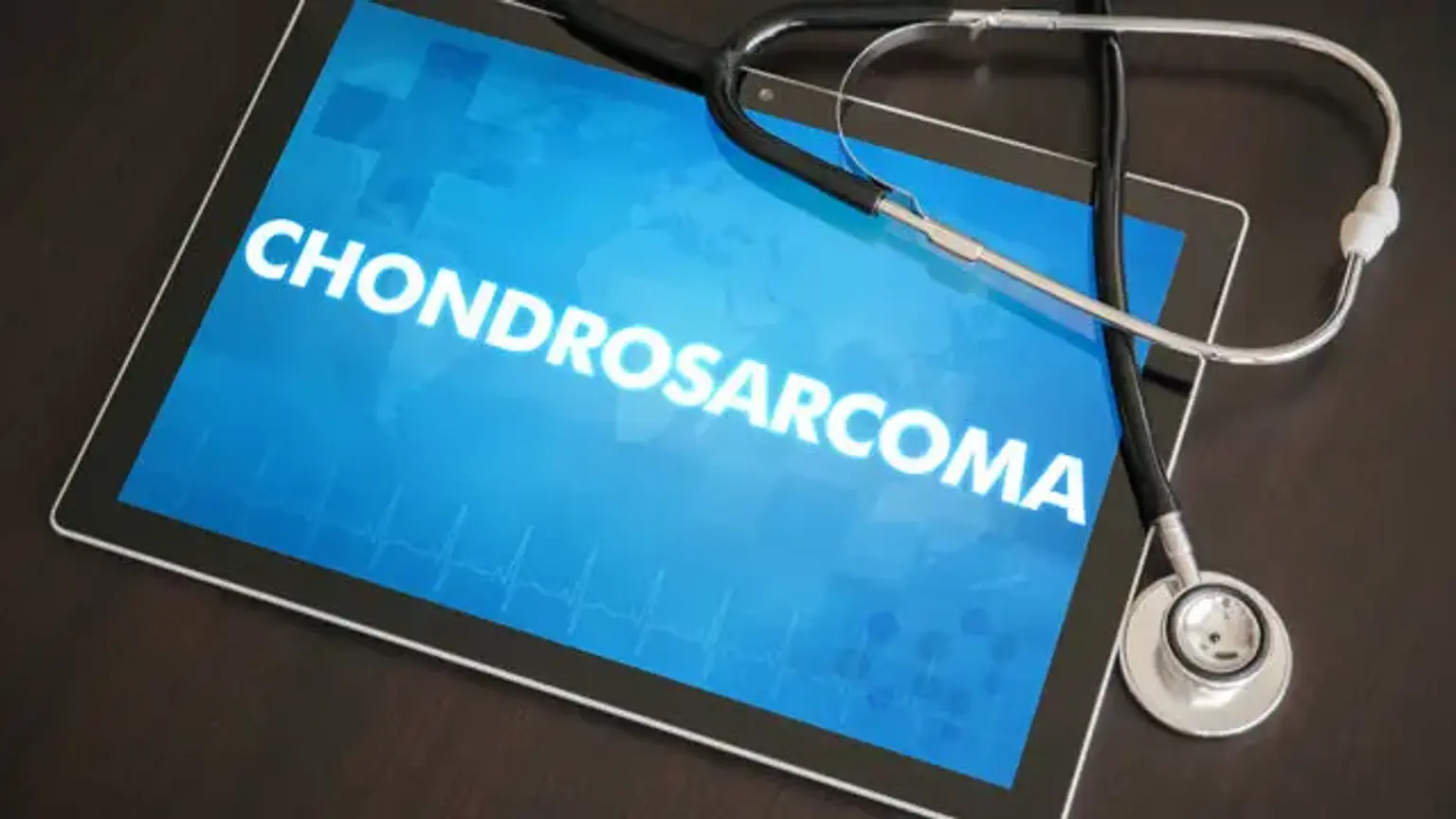 Chondrosarcoma