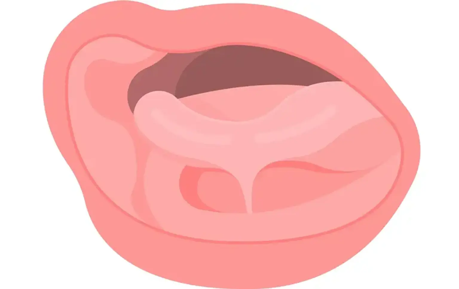 Frenectomy