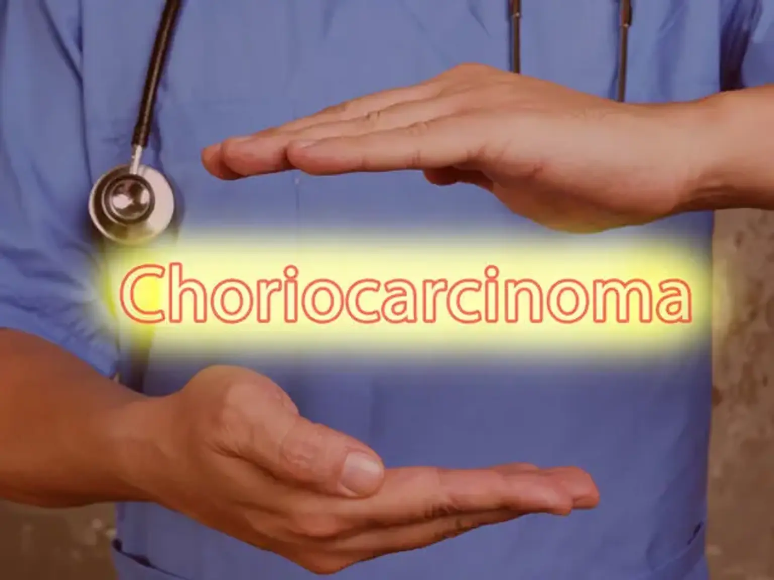 Choriocarcinoma