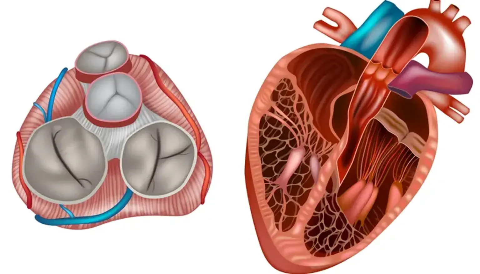 Valvular Heart Disease