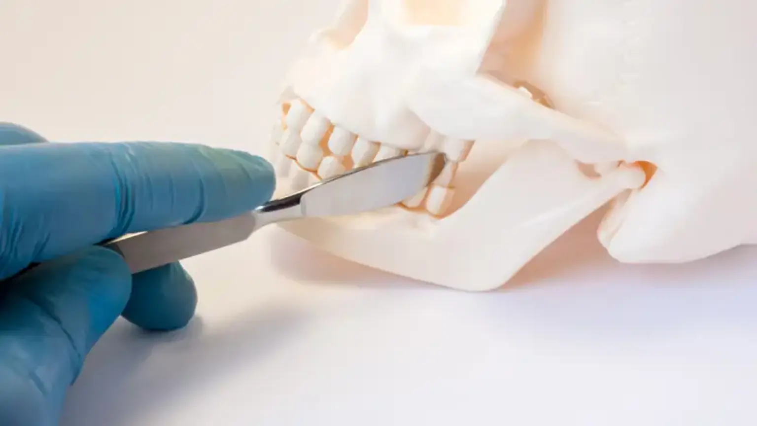 Orthognathic Surgery Cost by Countries