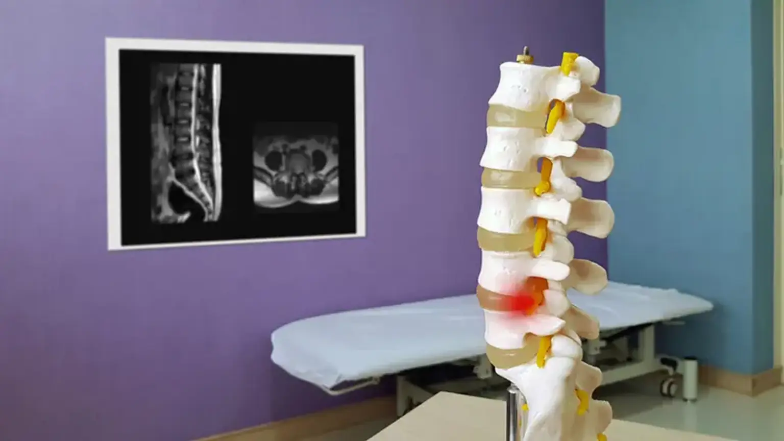 Endoscopic Epidural Neuroplasty