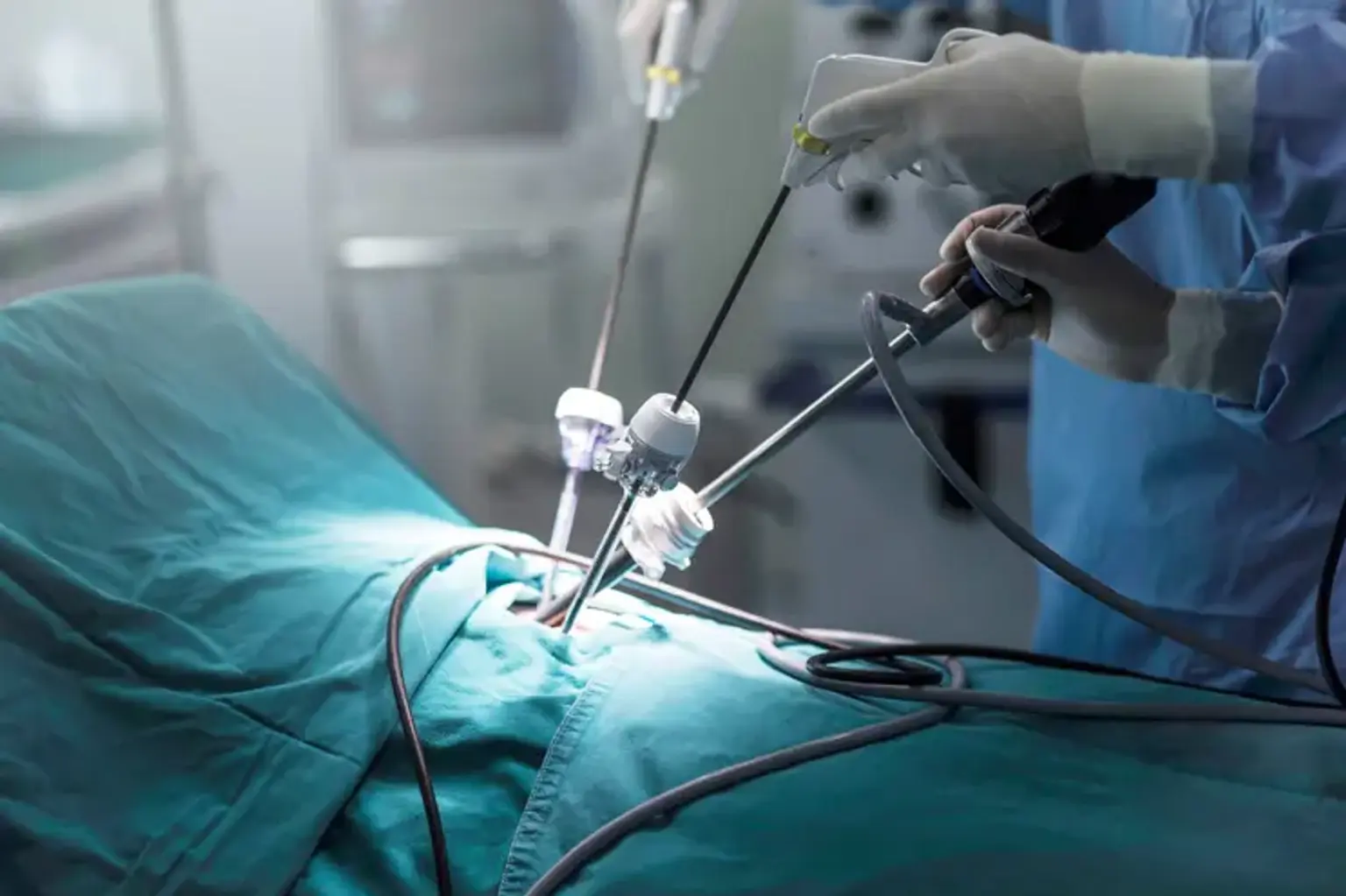 Laparoscopic surgery