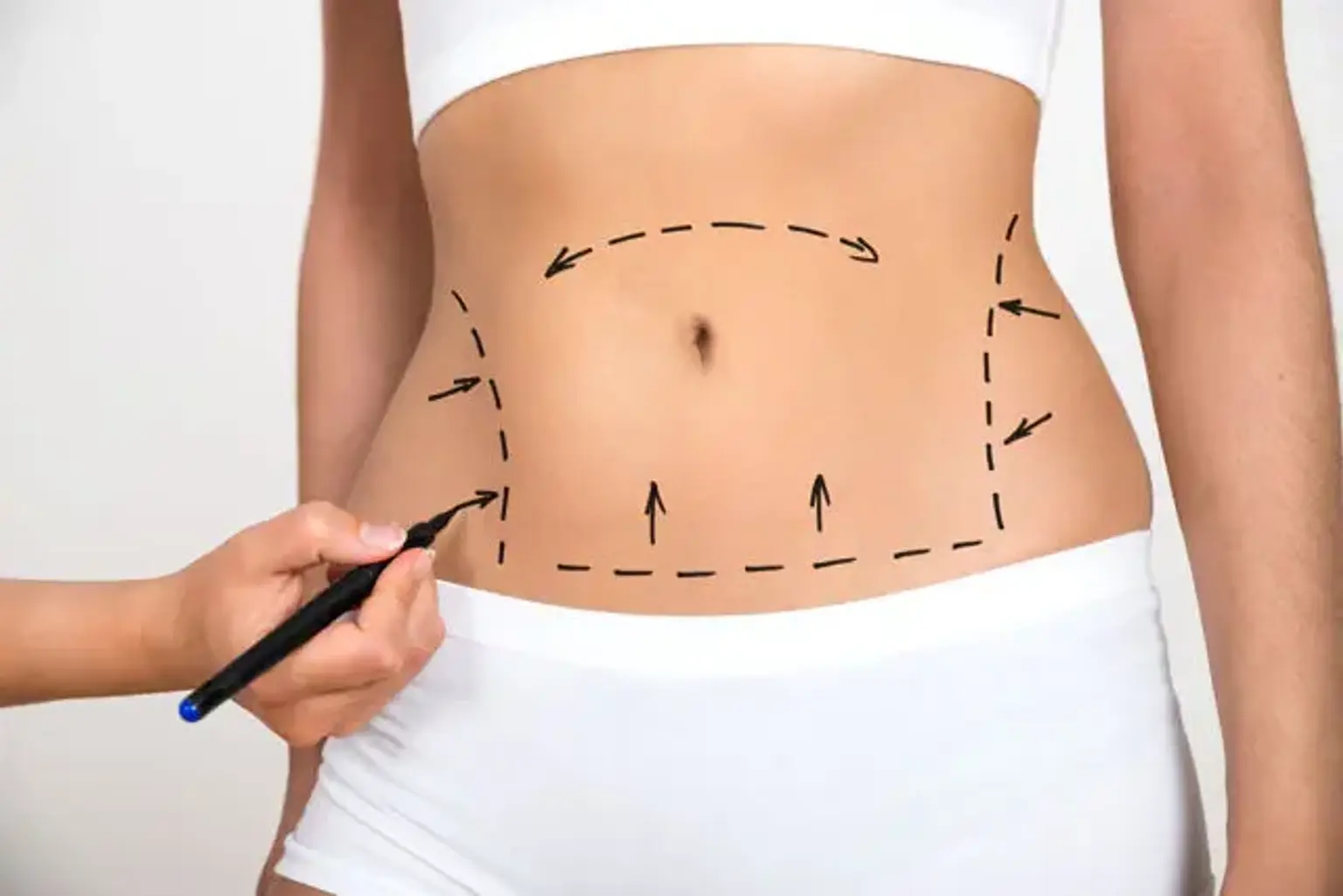 1-Liposuction-98099465-6cf7-42ee-a1c9-6f681ceb99aa.jpg