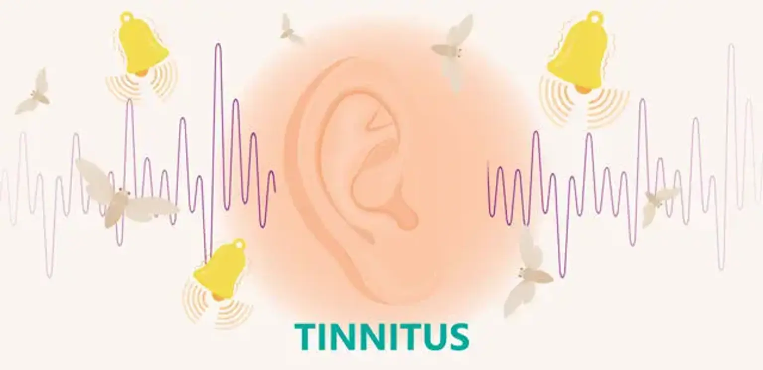 Tinnitus