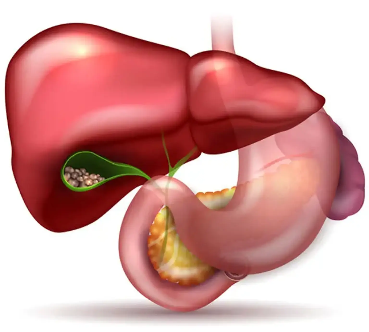 Biliary system disease