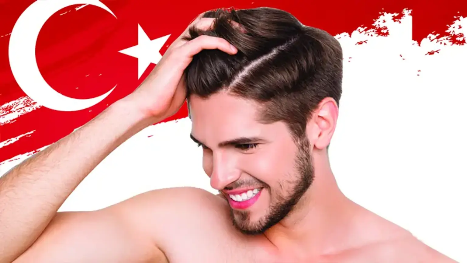 hair transplant in Turkey