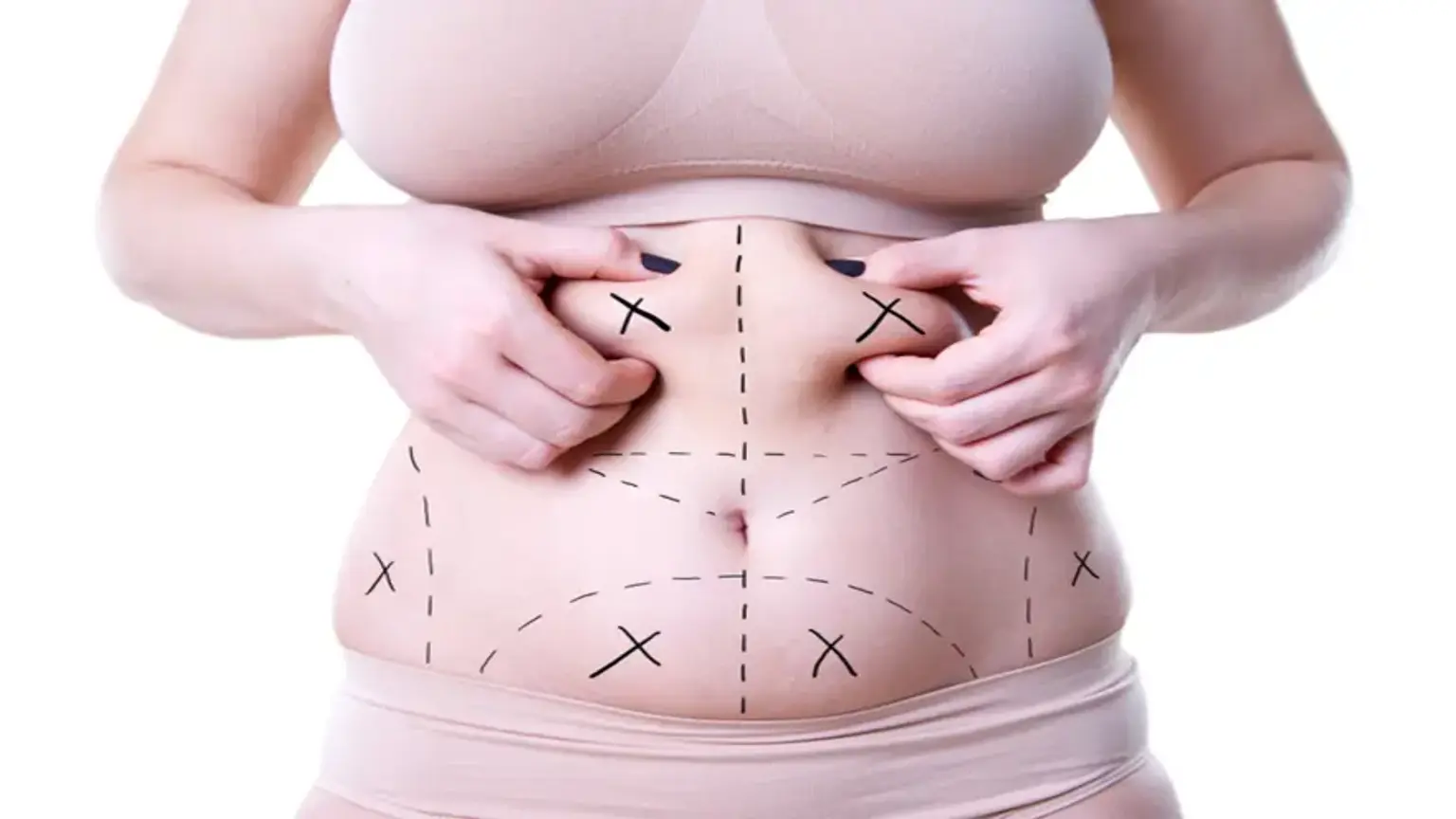Korean Fat-Dissolving Injections: A Quick Fix for Stubborn Fat