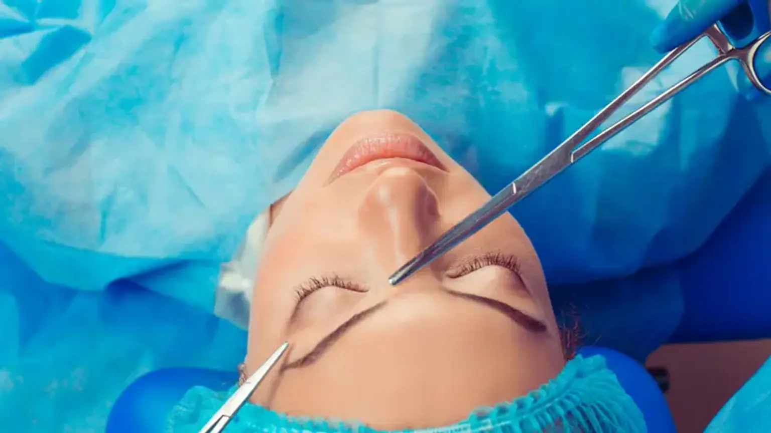 Sub-brow Lift Surgery