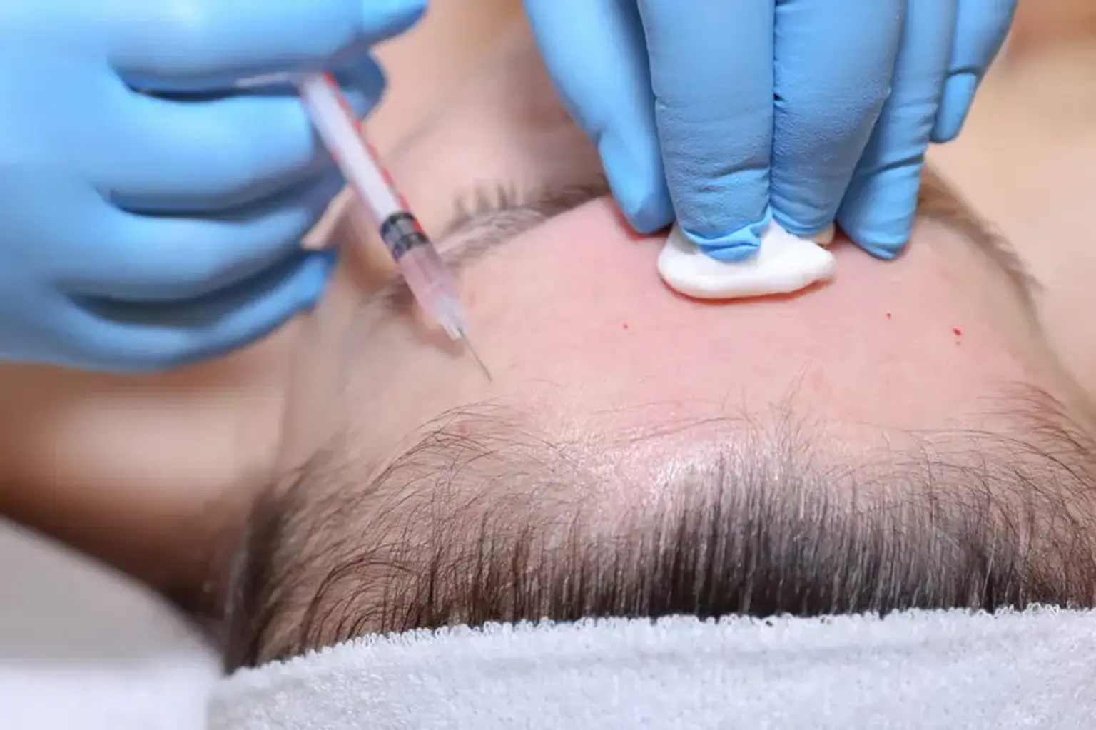 Forehead Reduction surgery