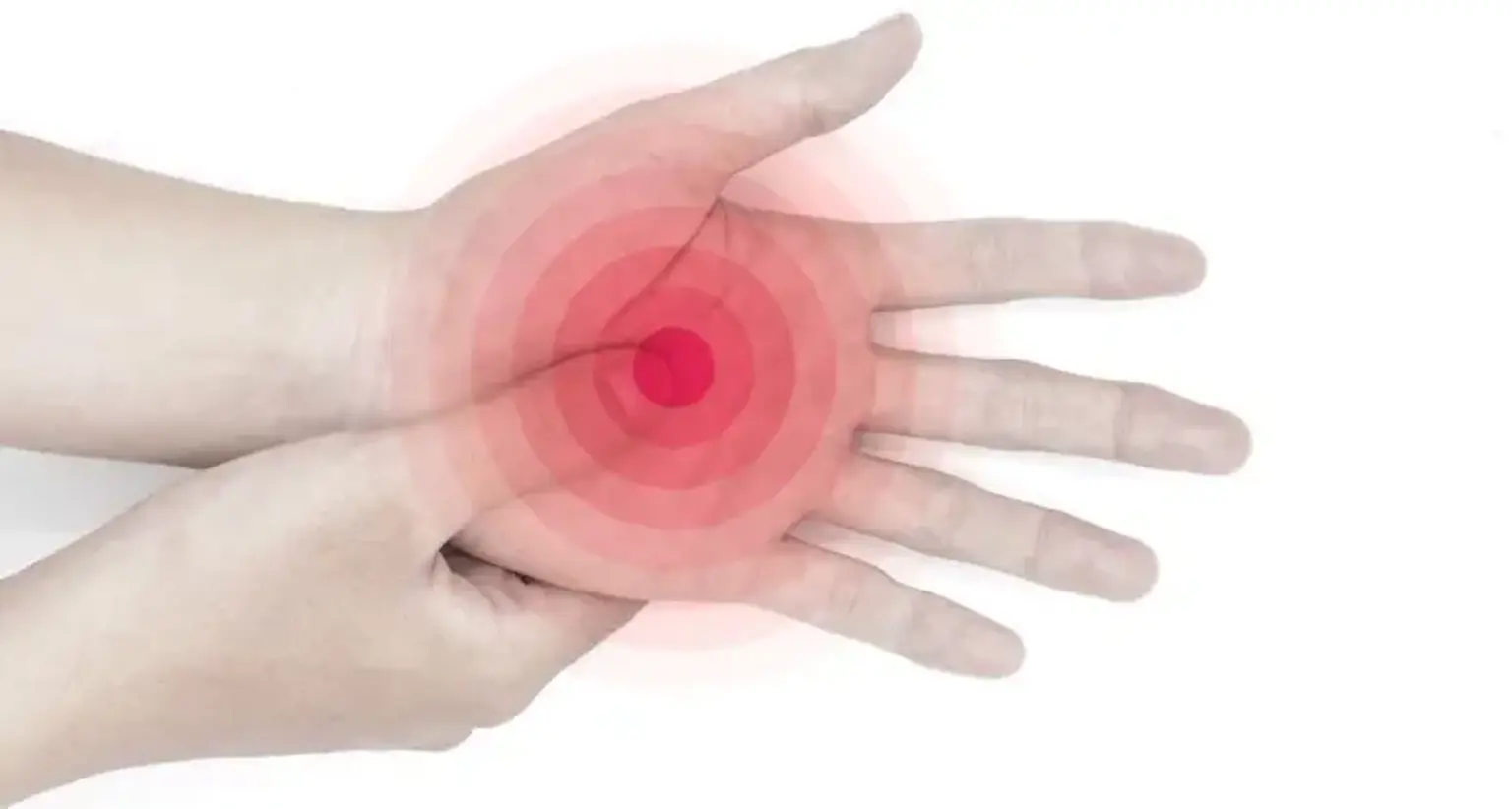 Compartment Syndrome