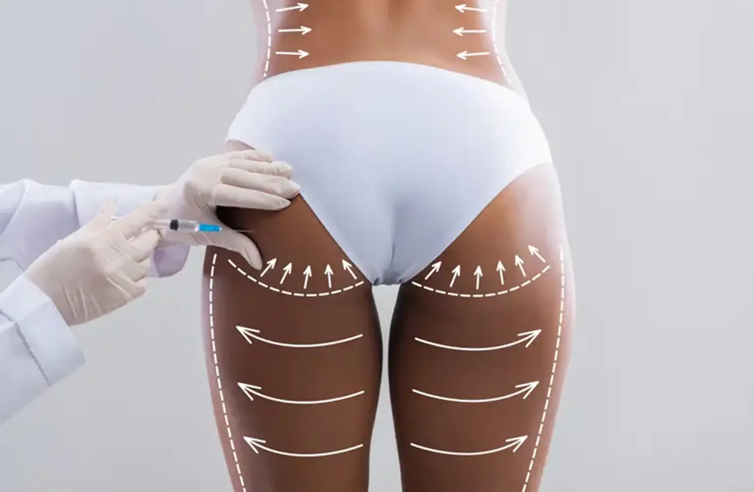 butt lift procedure