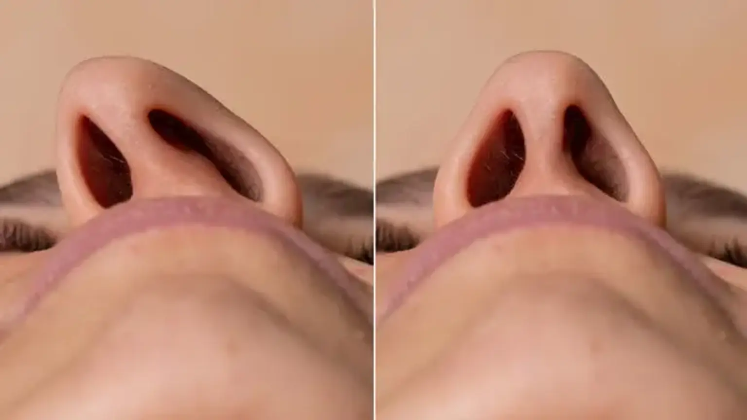 anatomy of the nose