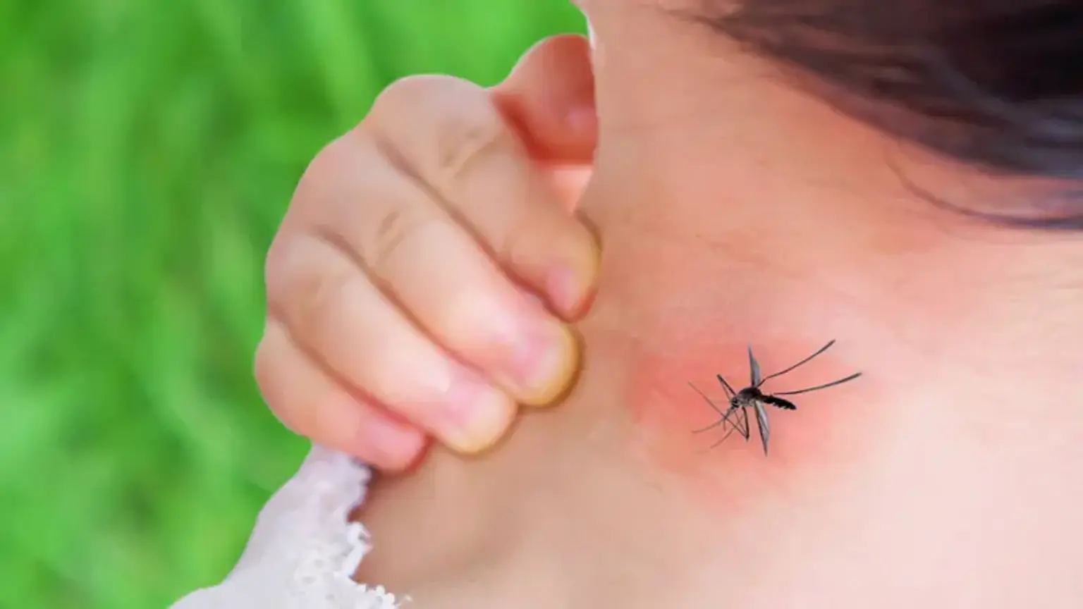 Dengue Fever Affect