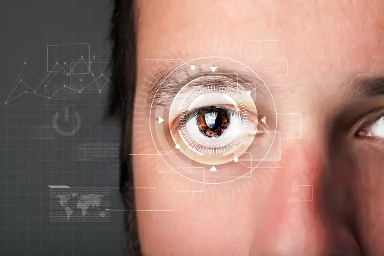 Managing High Myopia