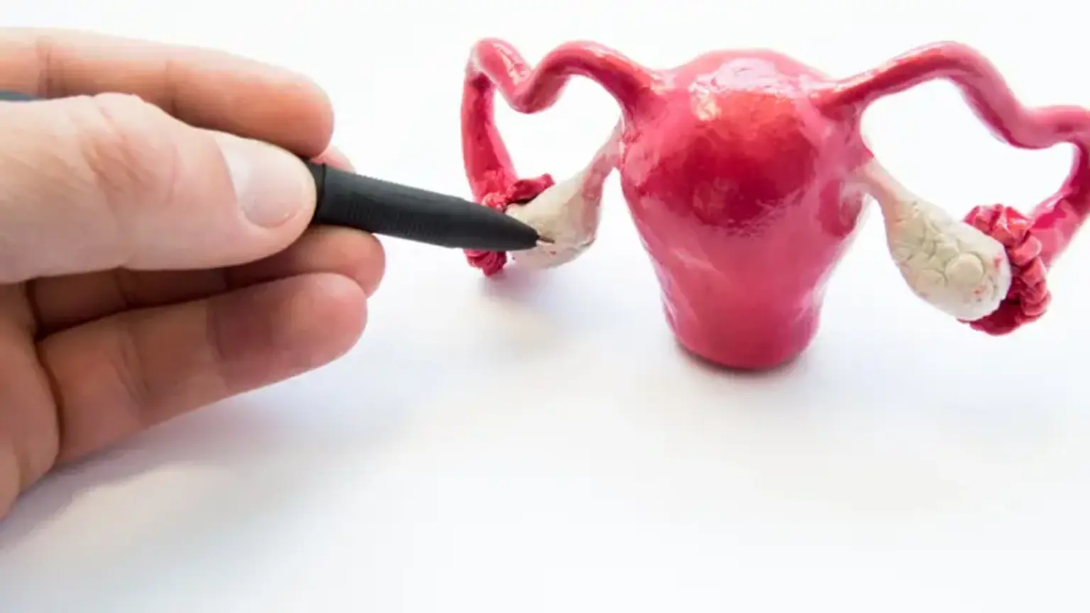 Anovulation
