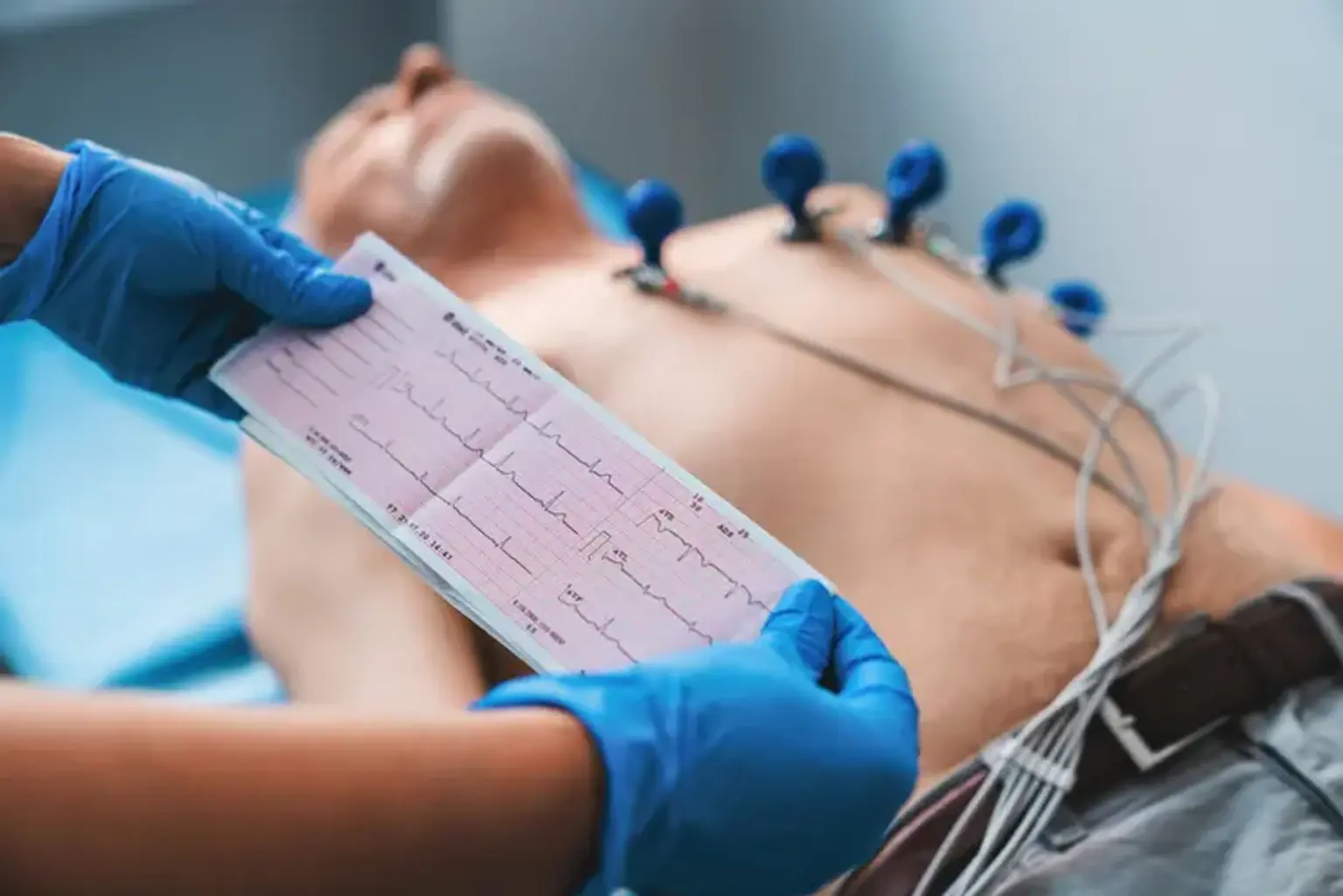 ECG Procedure