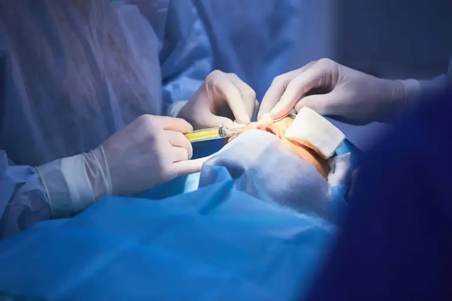 Procédures de chirurgie de la double paupière