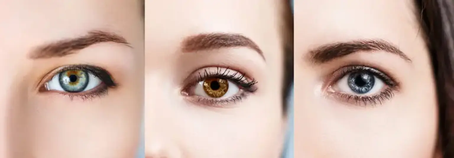 Eye color change