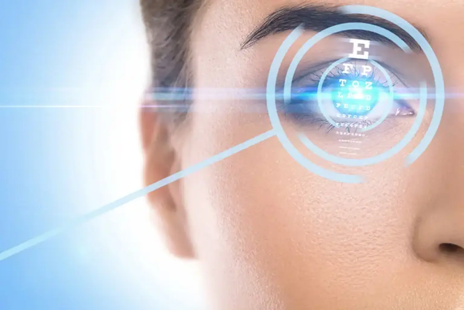 Operasi LASIK