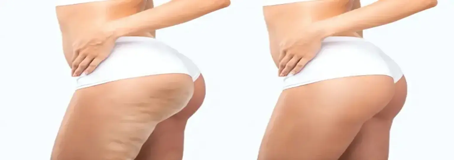 Лисичанскідегі секс видео