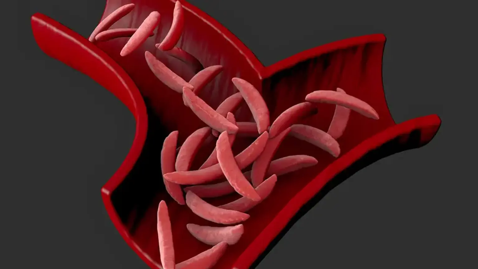 Blood Disorder Diagnosis and Management