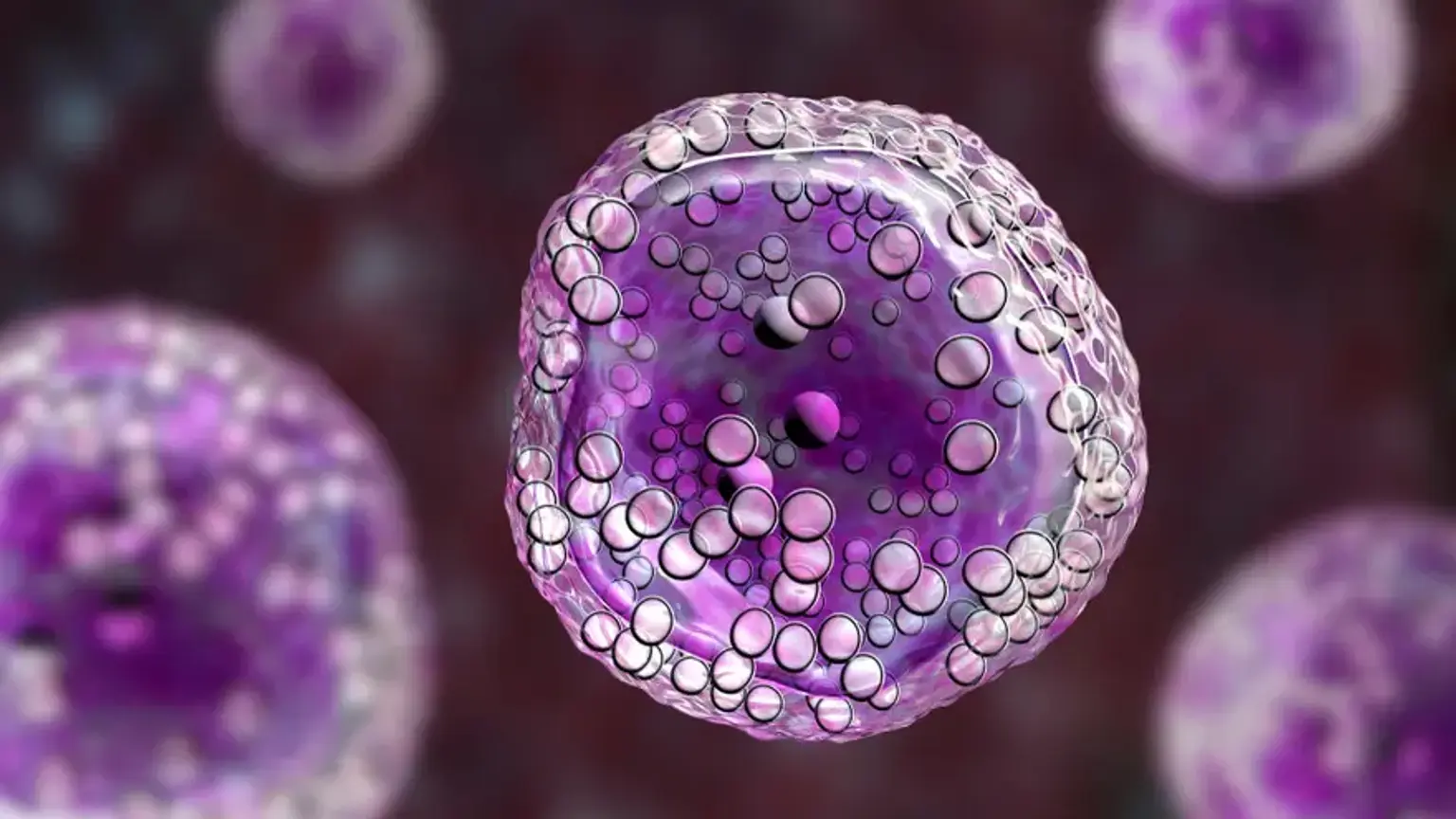 Burkitt Lymphoma Treatment Program