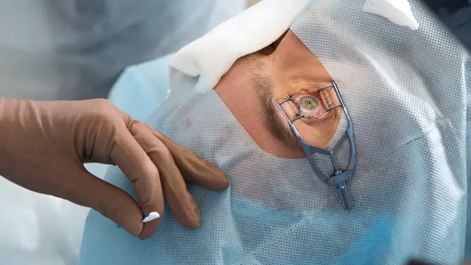 Corneal Transplantation