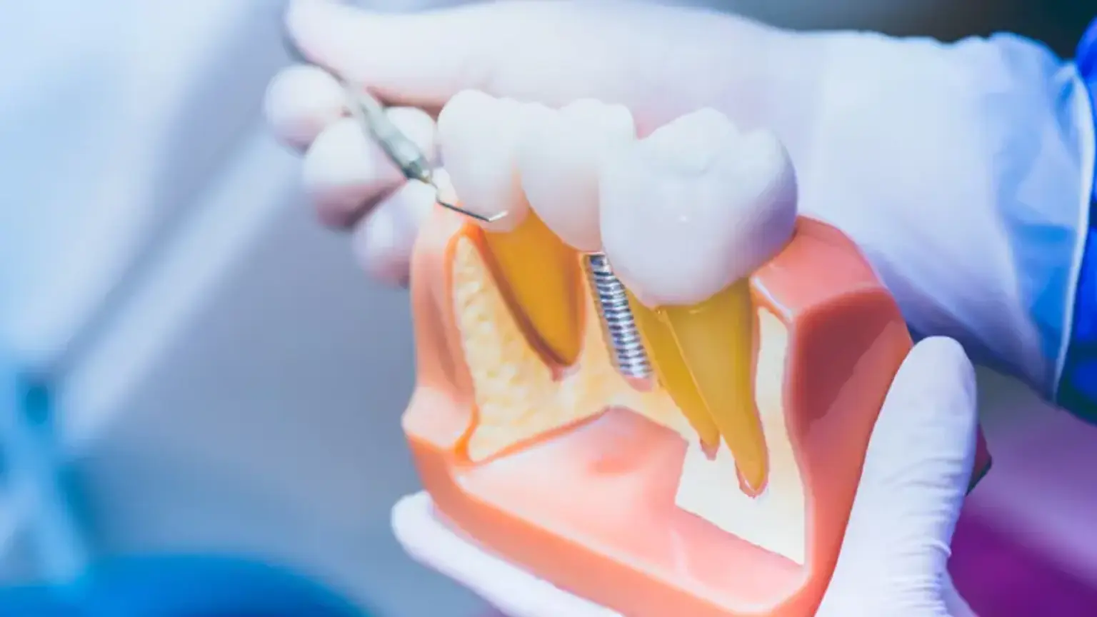 Dental Imaging