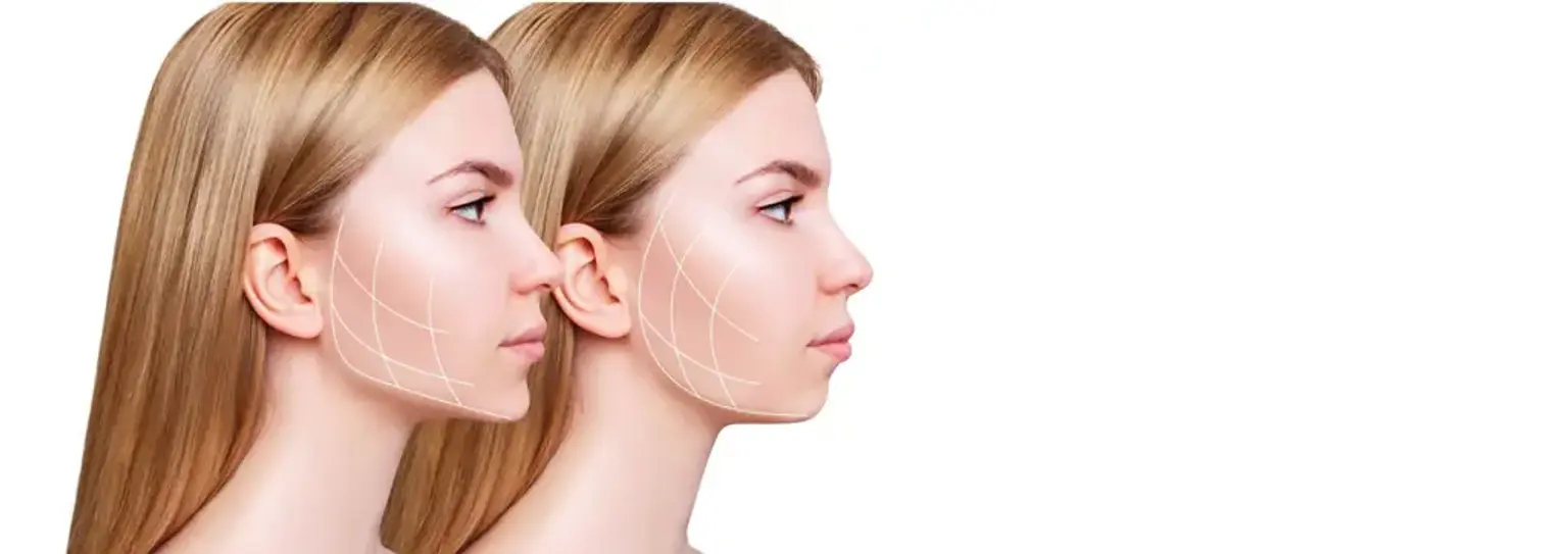 Orthognathic Surgery