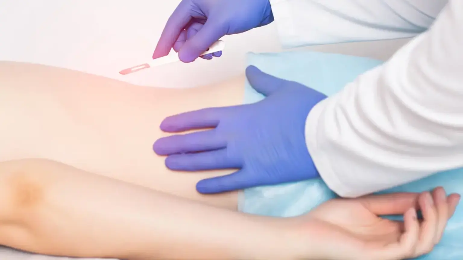 Posterior multi level spinal fusion