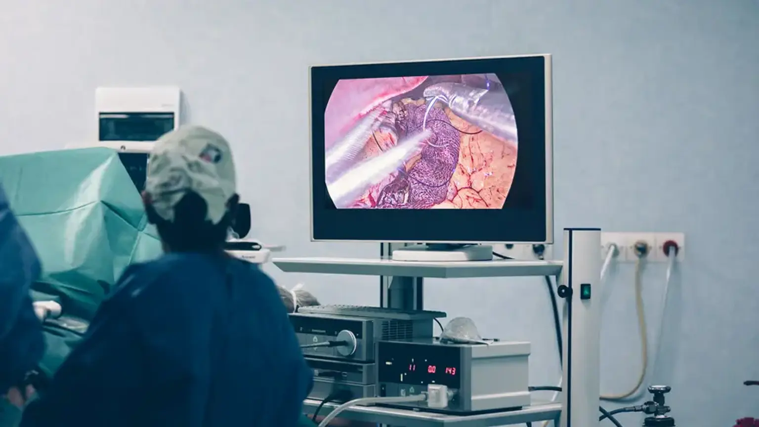 Gastric Balloon Procedure