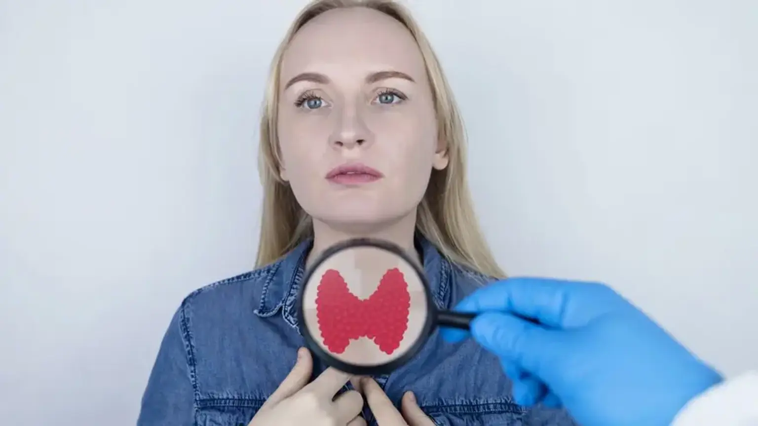 Graves’ Disease Treatment