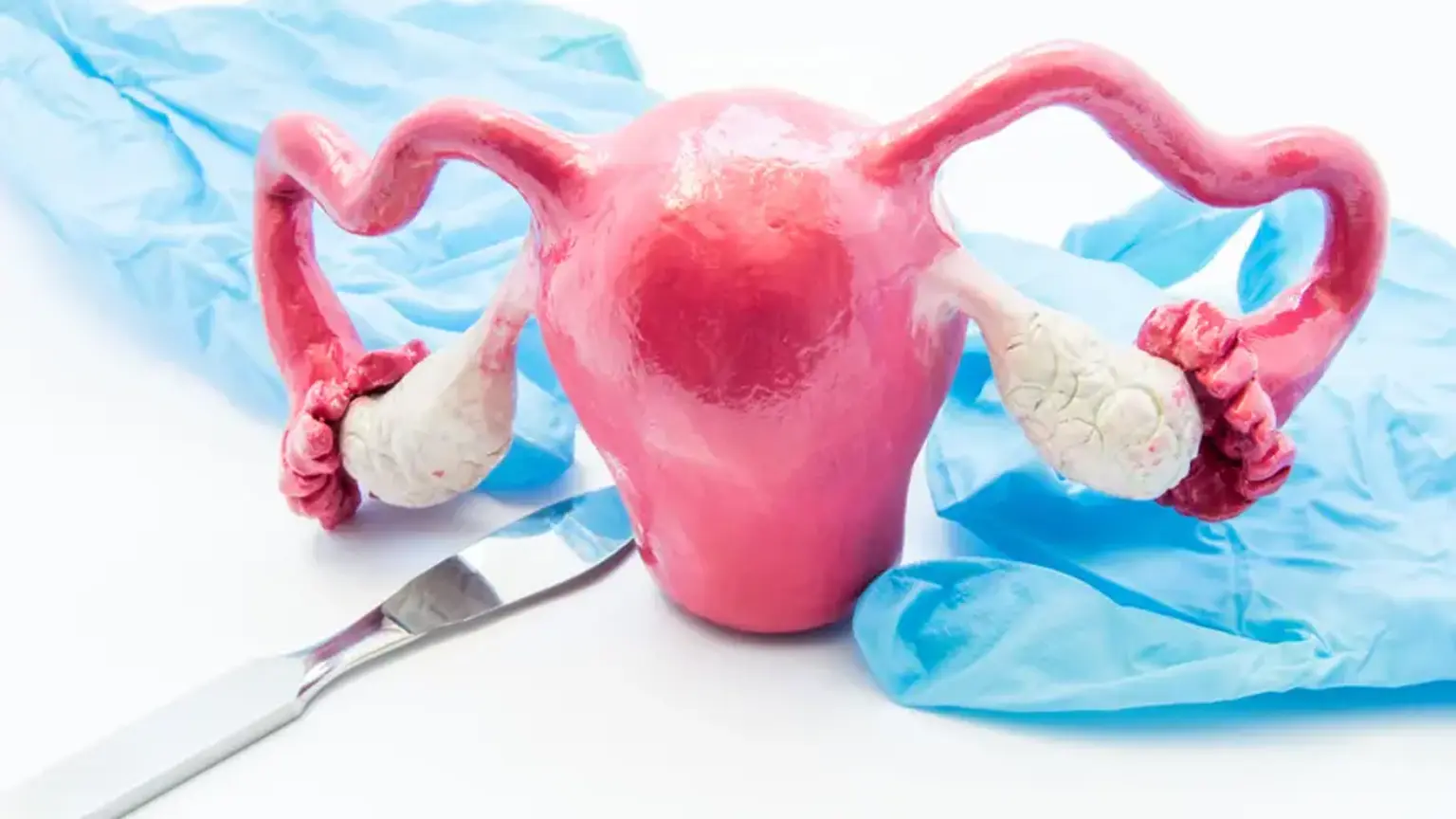 Hysterectomy