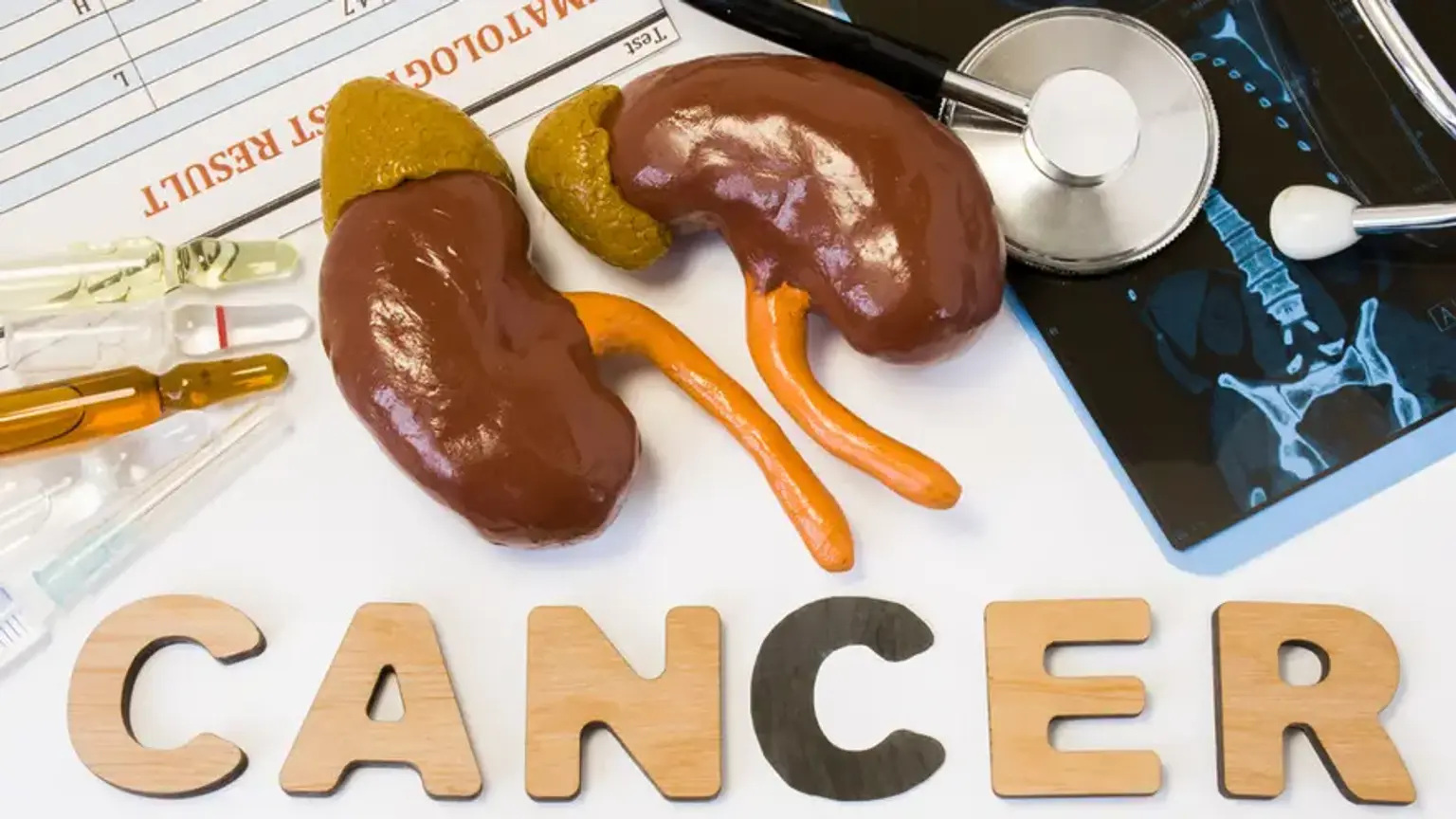 Kidney Removal Surgery