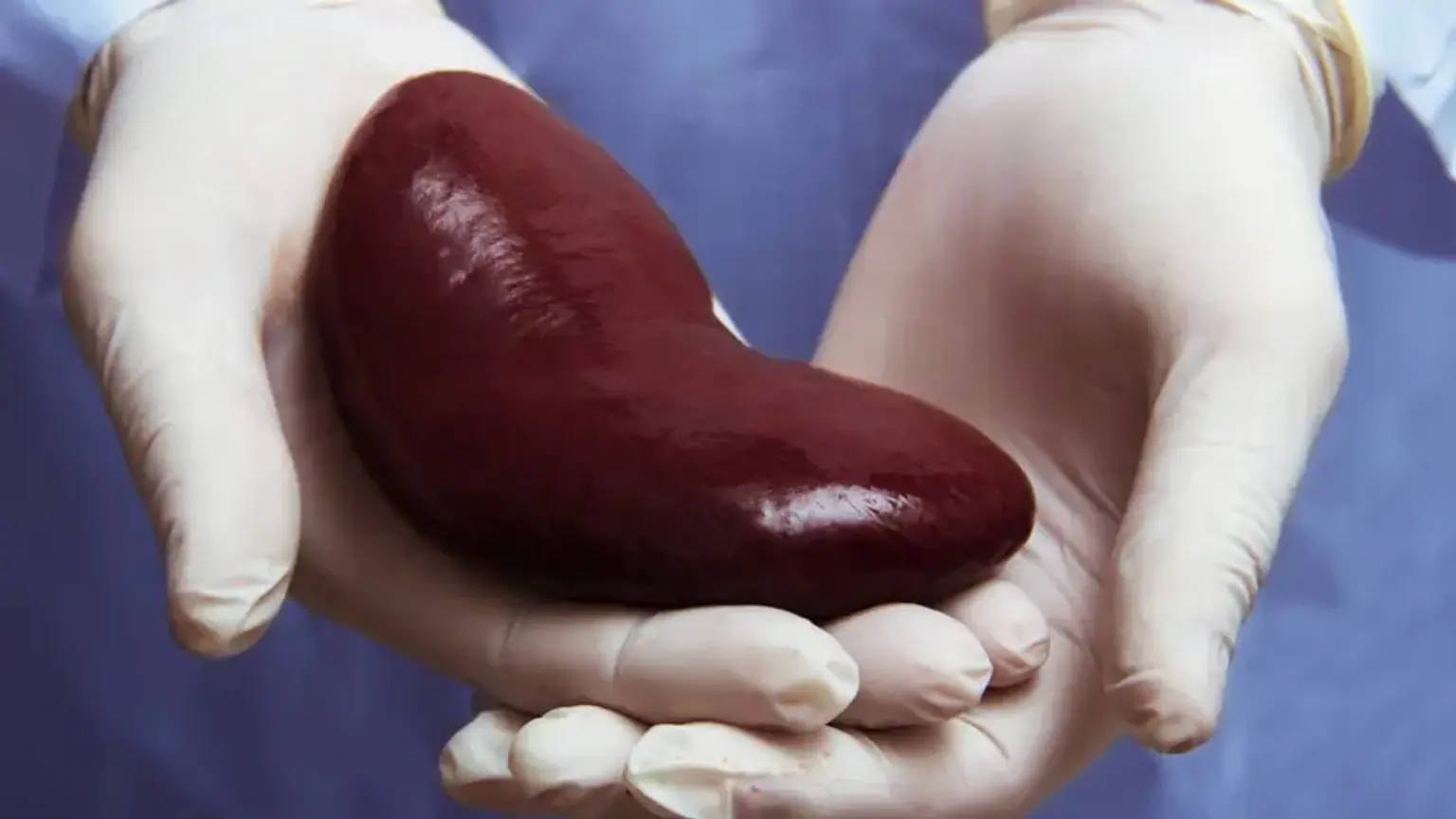 Kidney Transplantation